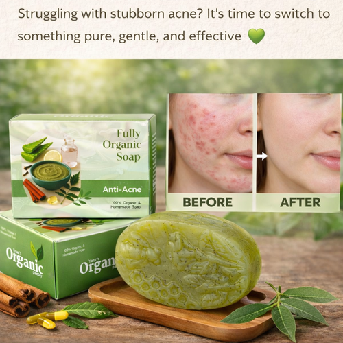 Organic anti-acne soap with packaging and before/after effects on skin.